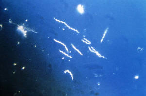 B. burgdorferi viewed at 400x under dark field microscopy. Public domain image courtesy of the CDC https://commons.wikimedia.org/wiki/File:Borrelia_burgdorferi_%28CDC-PHIL_-6631%29_lores.jpg